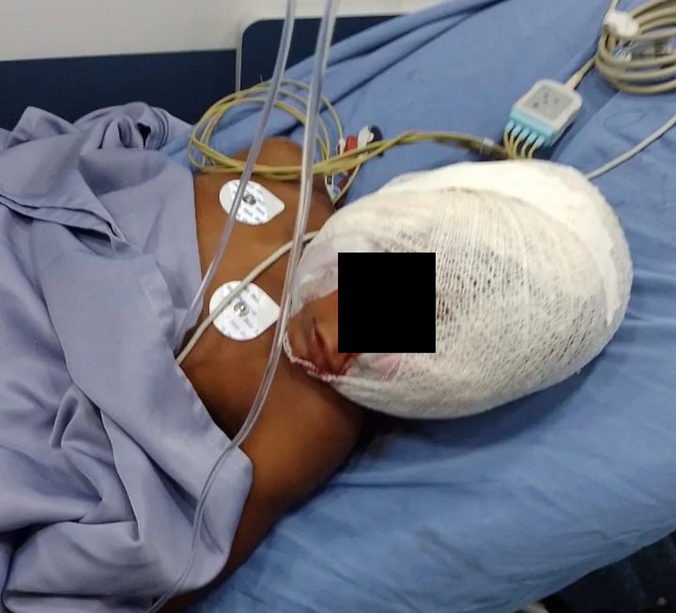 Menino de 5 anos é atacado por pitbull em São Pedro da Aldeia